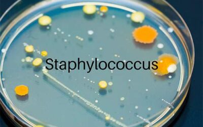 Staphylococcus epidermis