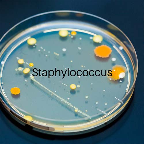 Staphylococcus epidermis